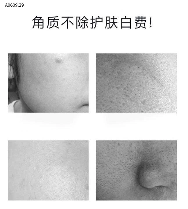 TẨY DA CHẾT toàn thân-Giá sỉ 75k/1 set 3 lọ 